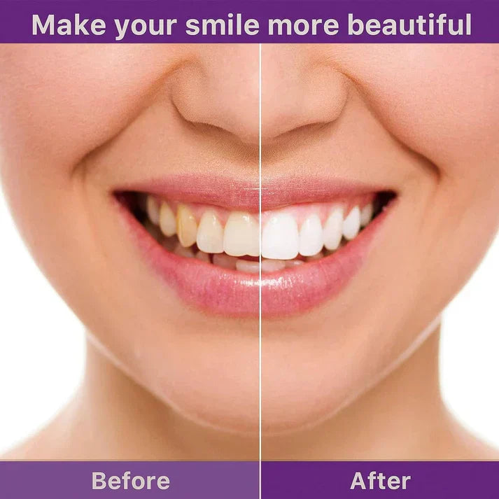 Hismile V34 Color Corrector Serum - Instant Teeth Whitening