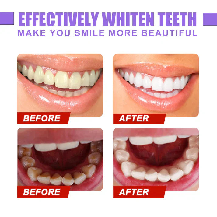 Hismile V34 Color Corrector Serum - Instant Teeth Whitening
